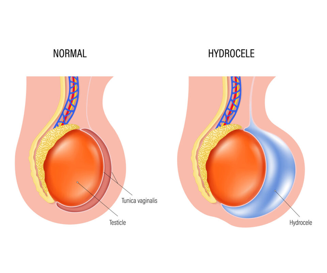 Healthcare consultation