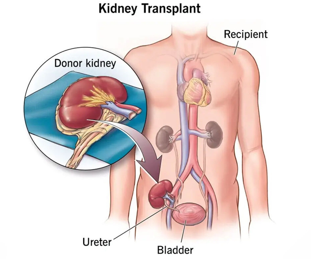Healthcare consultation