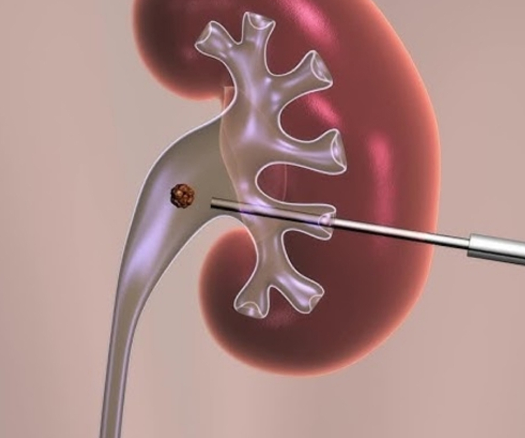 Healthcare consultation