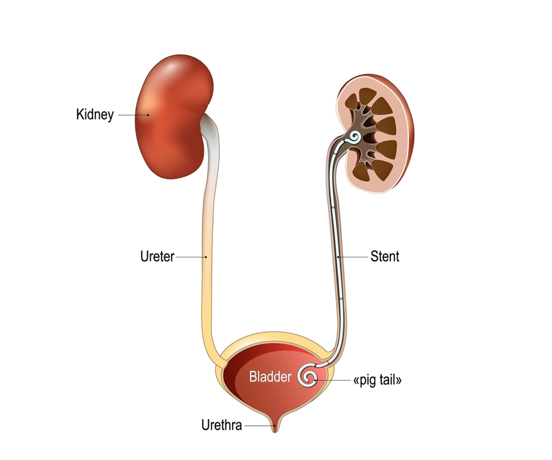 Healthcare consultation