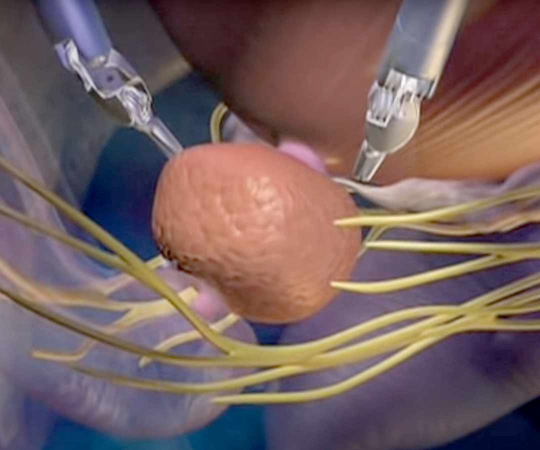 Healthcare consultation