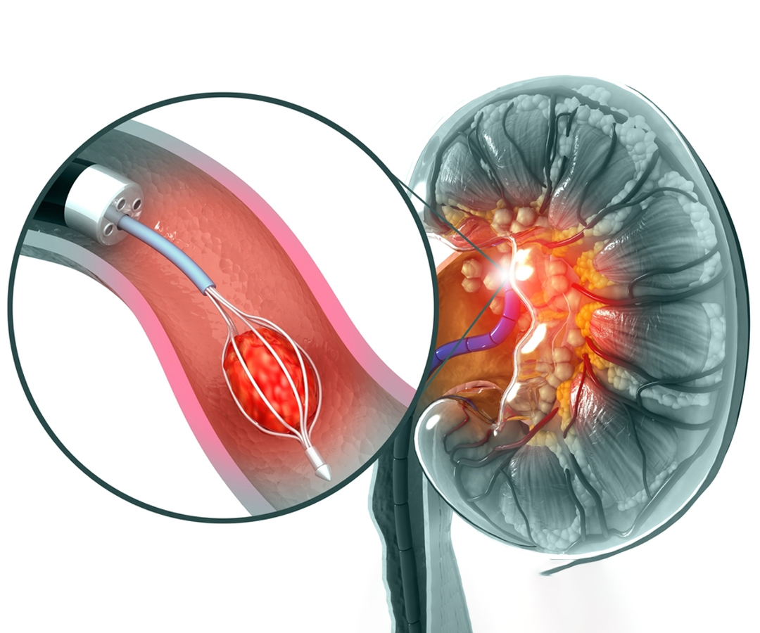 Healthcare consultation